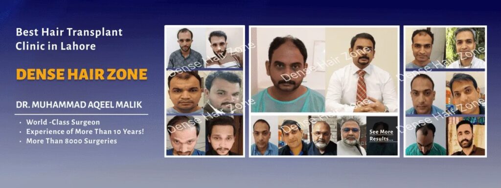 Hair Transplant in Lahore