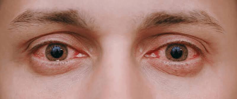 eye test at home